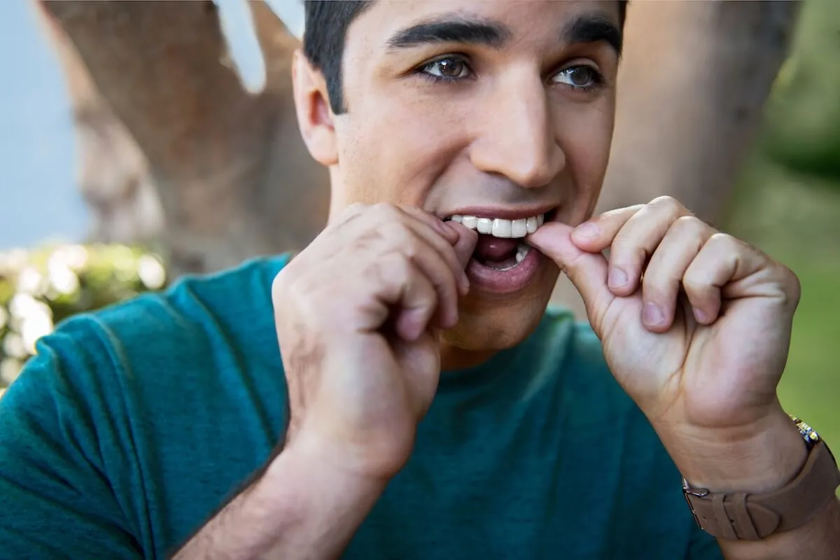 Invisalign sín behelyezése